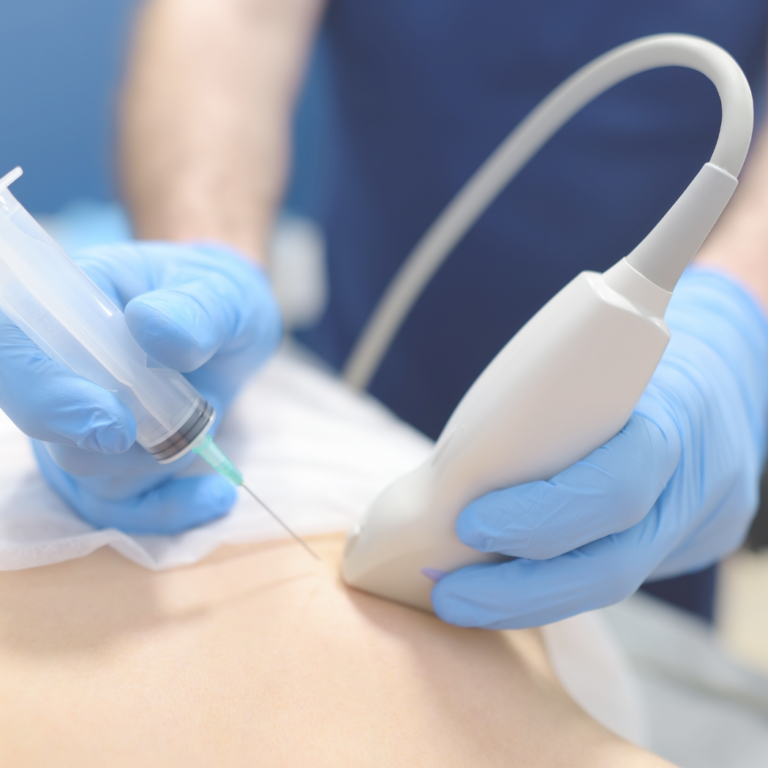 Punção de mama guiada por ecografia - Diagnóstico Precoce do Câncer de Mama